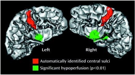 Brain anatomy illustration