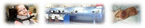 hyperbaric oxygen therapy-hbot